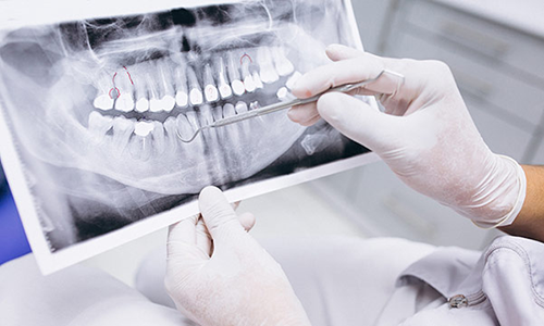 Стоматологічні послуги хірурга-стоматолога, збереження, лікування, видалення зубів